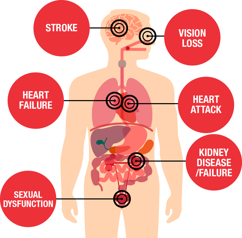 Causes of sudden Hypertension and its importance consequences