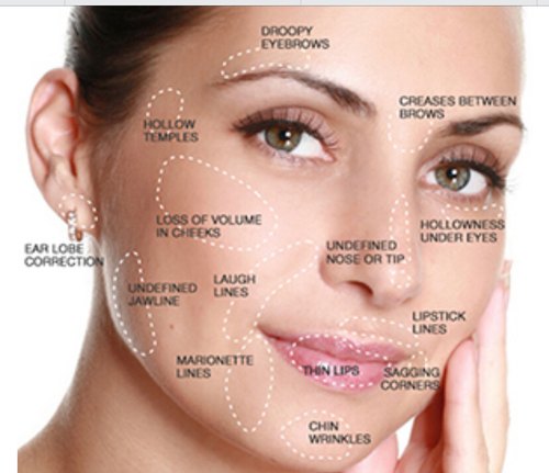 Things You Must Know About Ultherapy Treatment