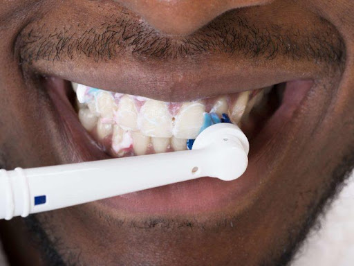 Is Cleaning Teeth Good or Bad?