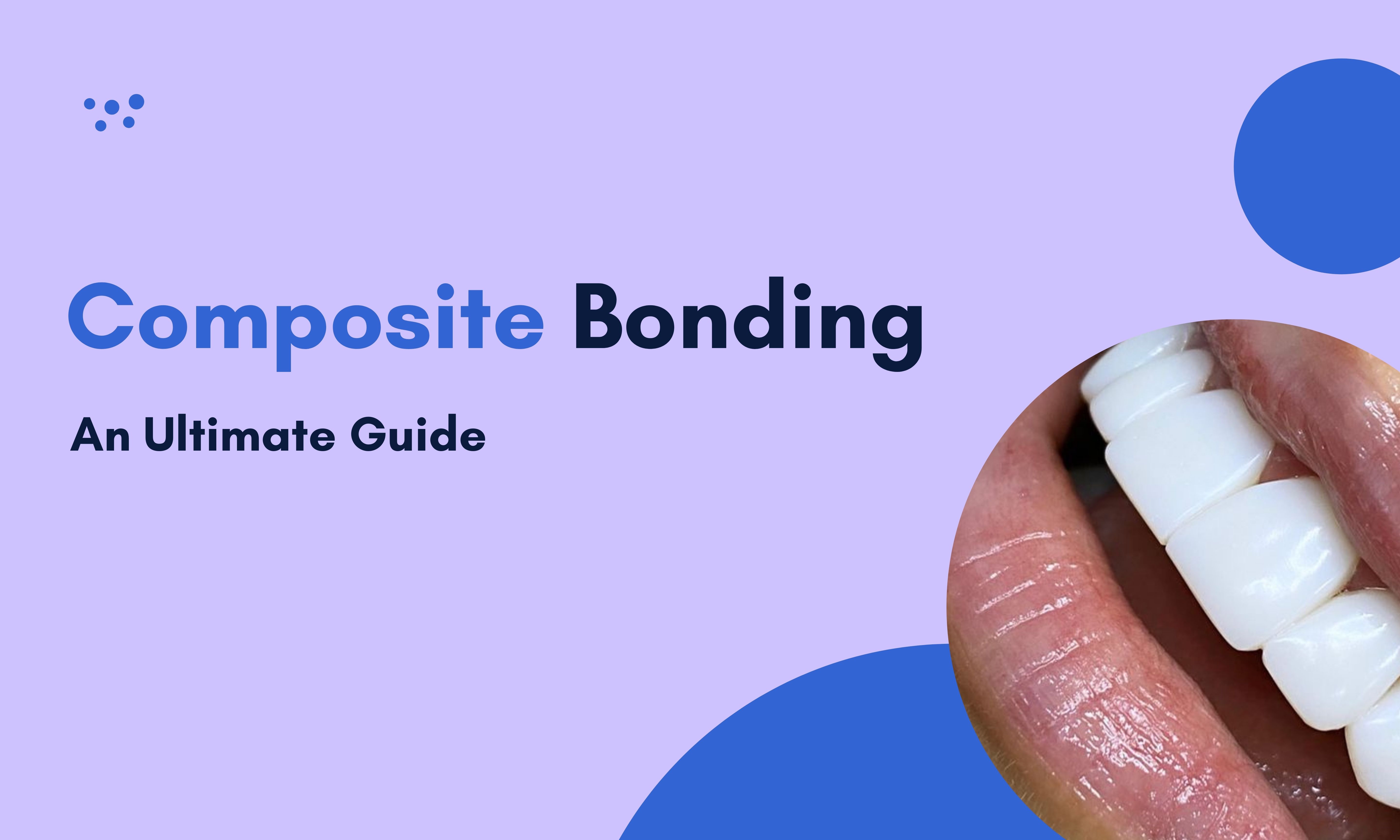 An Ultimate Guide to Composite Bonding