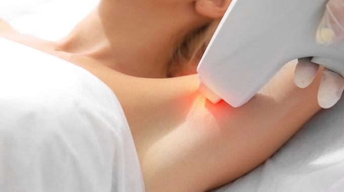 How Does Laser Hair Removal Work?