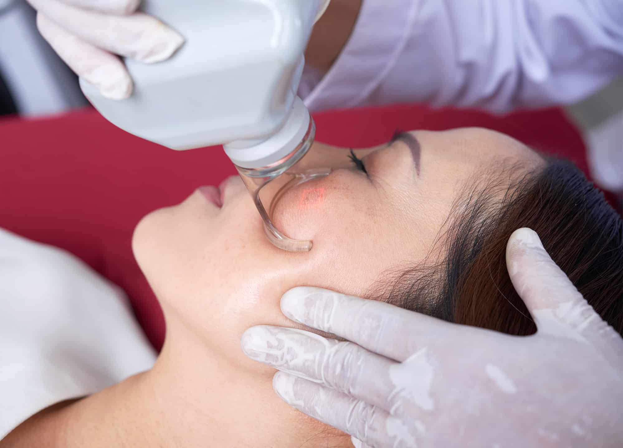 Nine Effective Treatments for Acne
