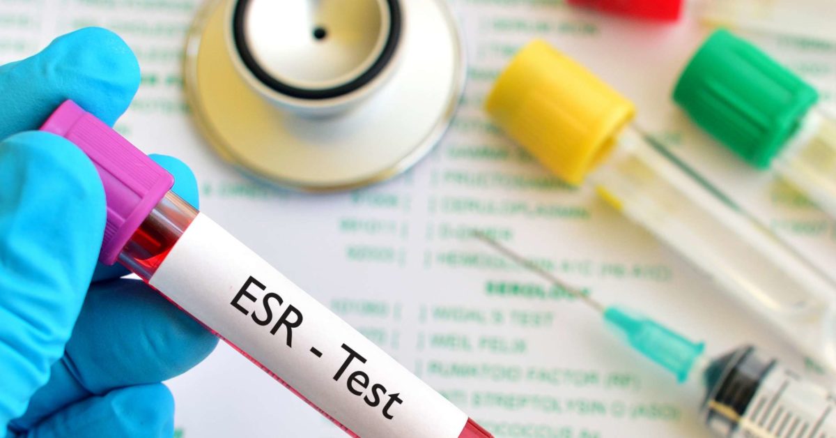All You Need to Know About Esr Test