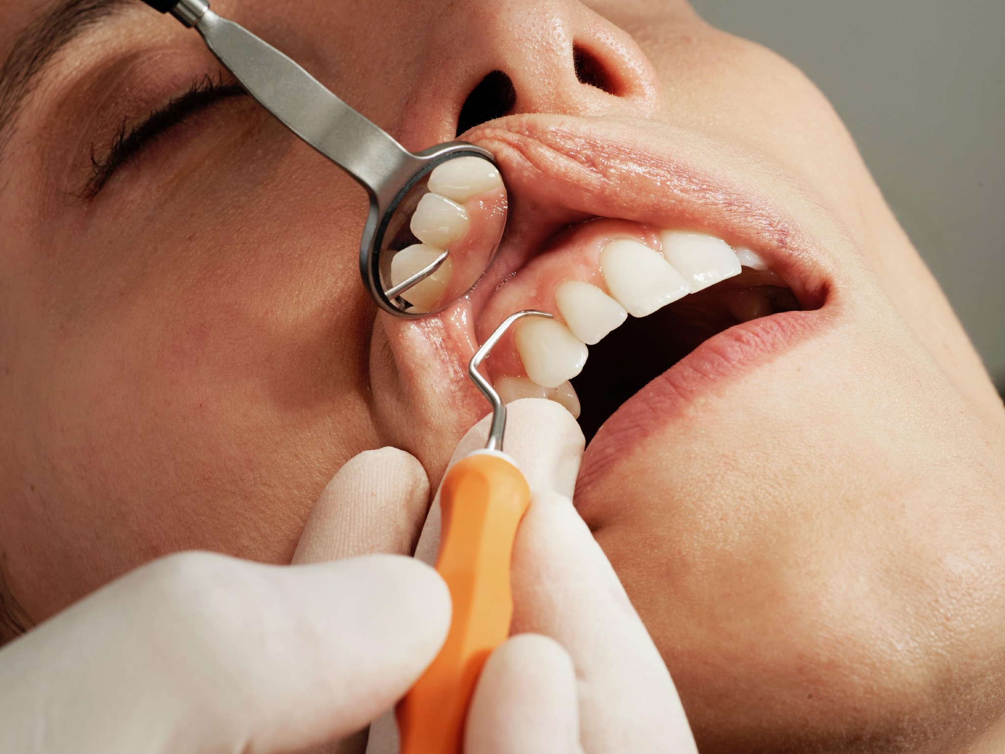 Important Things You Have to Look in a Cosmetic Dentist