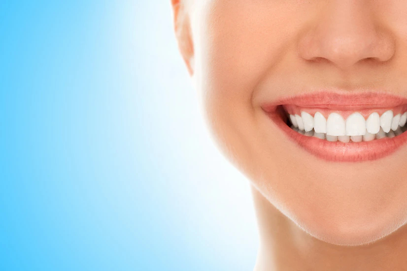 Do Teeth Whitening Treatments Really Work ? The Truth About Teeth Whitening