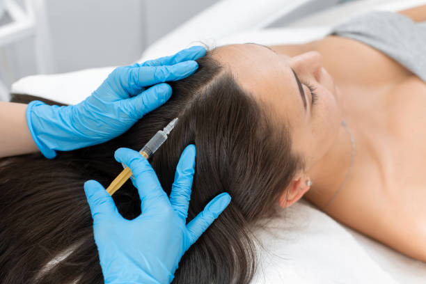 PRP Hair Treatment Maintenance: How Often Should You Repeat Sessions