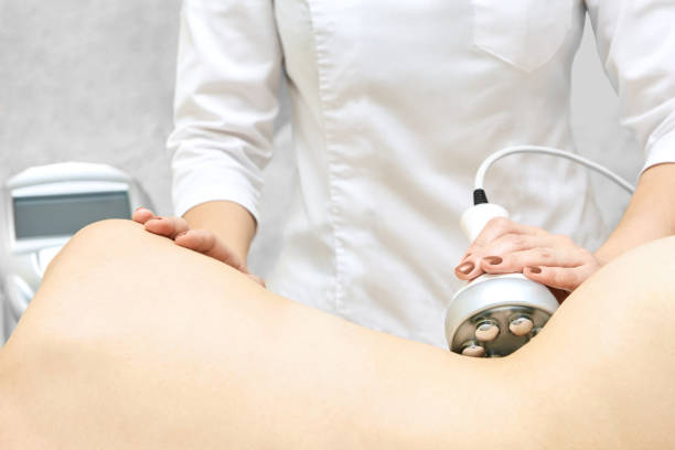 What to Expect From a Venus Legacy Skin Treatment Plan
